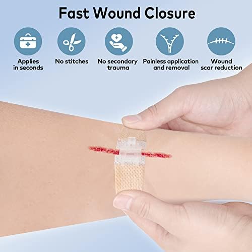 רצועות סגירת פצעים, תחבושות פרפר של GBHOMIVY לסגירת פצעים, מכשיר סגירת עור מיקוד של ה- FDA לטיפול בפצעים,