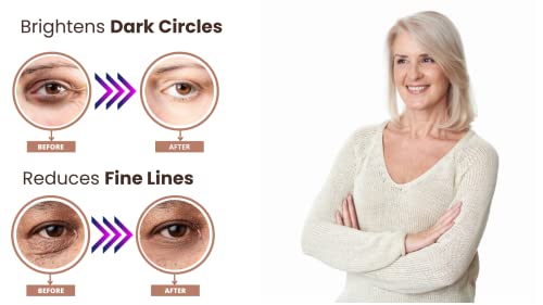 IE - מסכת עיניים מזהב 24 קראט - 16 זוגות לעיניים מחודשות - מפחית עיגולים כהים, נפיחות, קווים עדינים וקמטים.