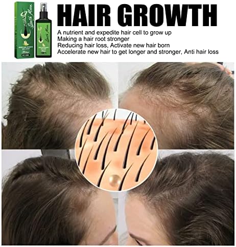 ג ' ינג 'ר מזין תרסיס, אורגני מהיר צמיחה בתוספת מזין ג' ינג ' ר תרסיס טבעי צמיחת שיער, עבור גברים נשים אנטי שיער אובדן