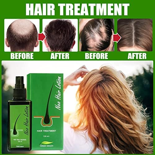 סרום צמיחת שיער ביניקאסה לשיער דליל לגברים ונשים, קרם שיער לצמיחת שיער, סרום צמיחת שיער מהיר, אנטי נשירת