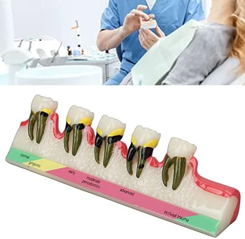 DentalPathological Model, אנגלית מילות מפתח חינוכיות שיניים חסימות דמי -מודל מובהקות עבור דנטלוספיטלים